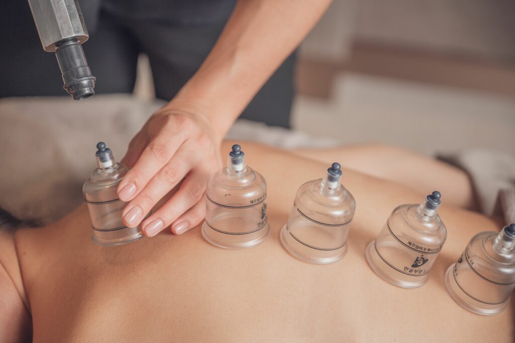 masseur using cupping therapy on her client 2023 04 26 21 11 25 utc Dry Cupping